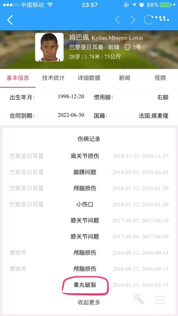 姆巴佩睾丸破裂是怎么回事-姆巴佩睾丸撕裂是不是真的